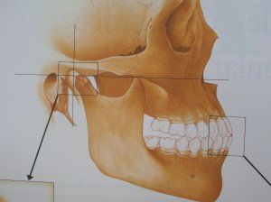 Cómo marcar la mandíbula sin cirugía – Clínicas Esquivel